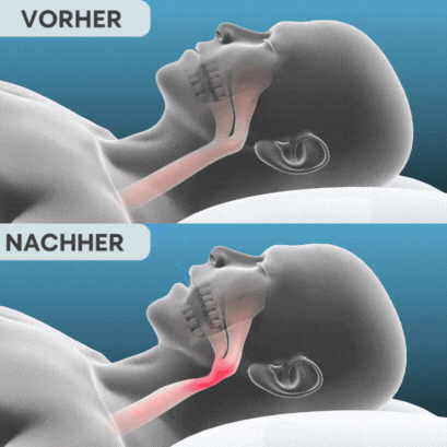 LEVORA PRO SCHNARCHSCHIENE