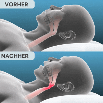 Levora Pro Wirkungsweise Diagramm